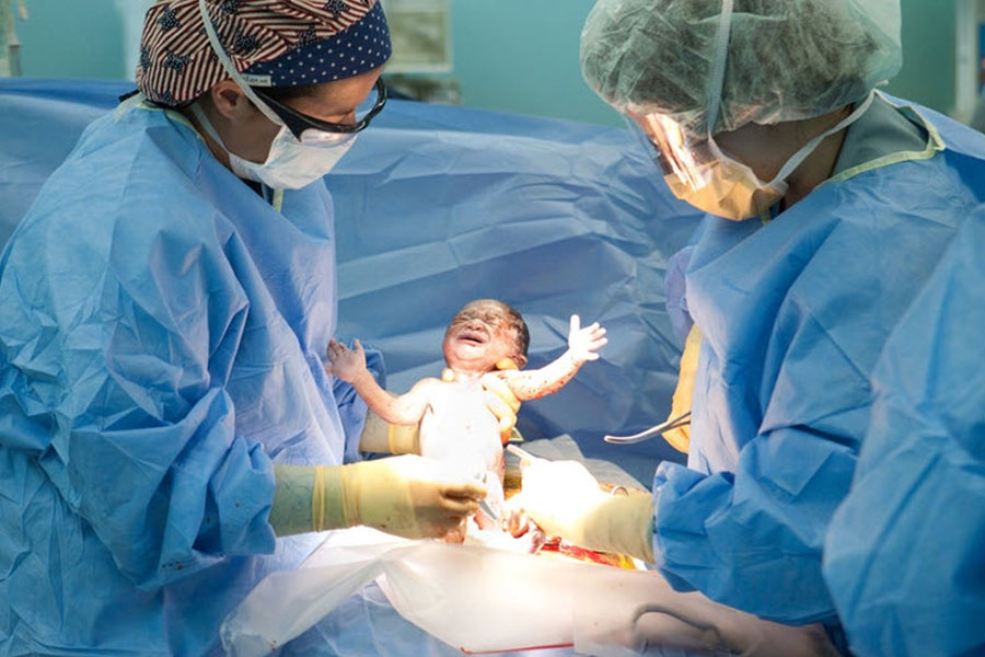 جراحی سزارین بهترین گزینه برای به دنیا آوردن نوزادانی است که با پا یا باسن وارد کانال زایمان میشوند